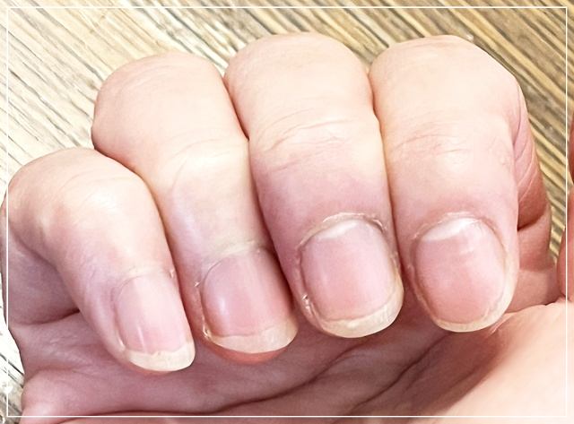 ほったらかしでガサガサになった汚い指先